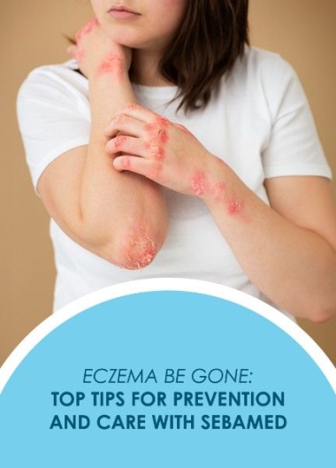 Eczema Be Gone: Top Tips for Prevention and Care with Sebamed